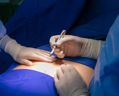 General & Laparoscopic Surgery